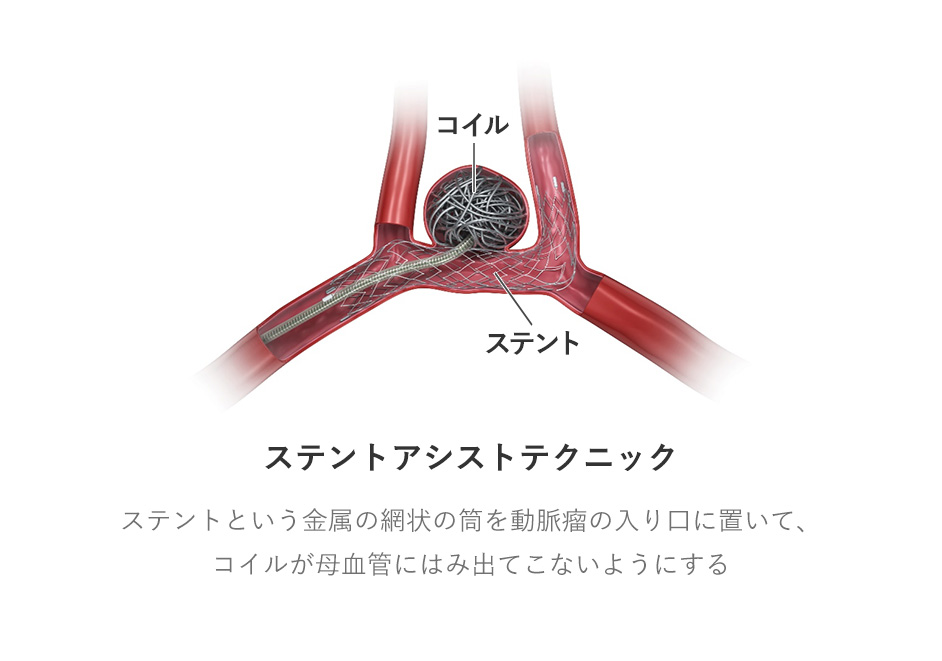 考慮すべきリスク