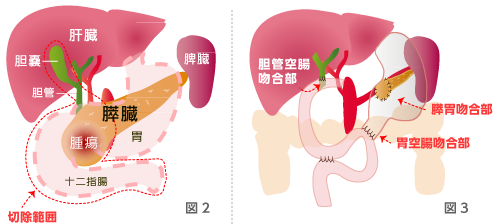 それは何ですか？