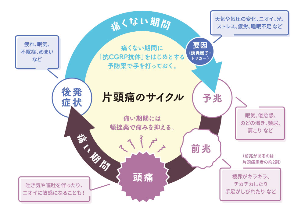 片頭痛のサイクル