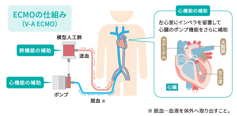 ECMOの仕組み