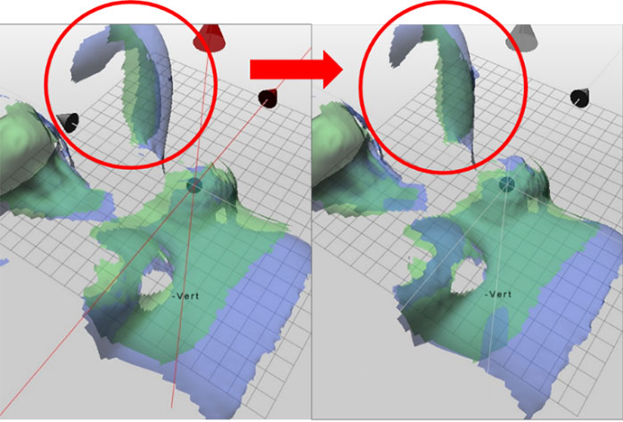 Catalystシステム位置合わせの様子