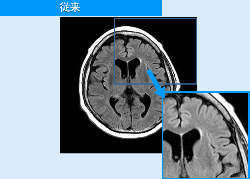 より高画質に 従来